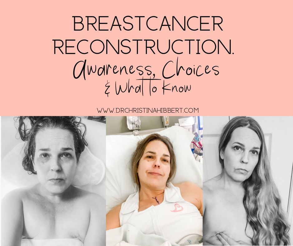 Breast Reconstruction - National Breast Cancer Foundation